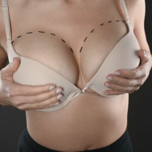 breast reduction surgeon in Huntington NY