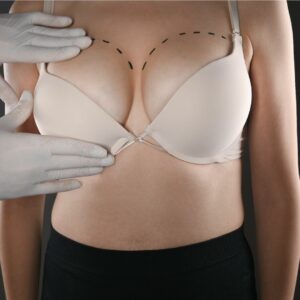 breast augmentation in Melville, NY