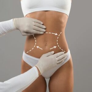 Post-Weight Loss Body Contouring Long Island - Dr. Buglino